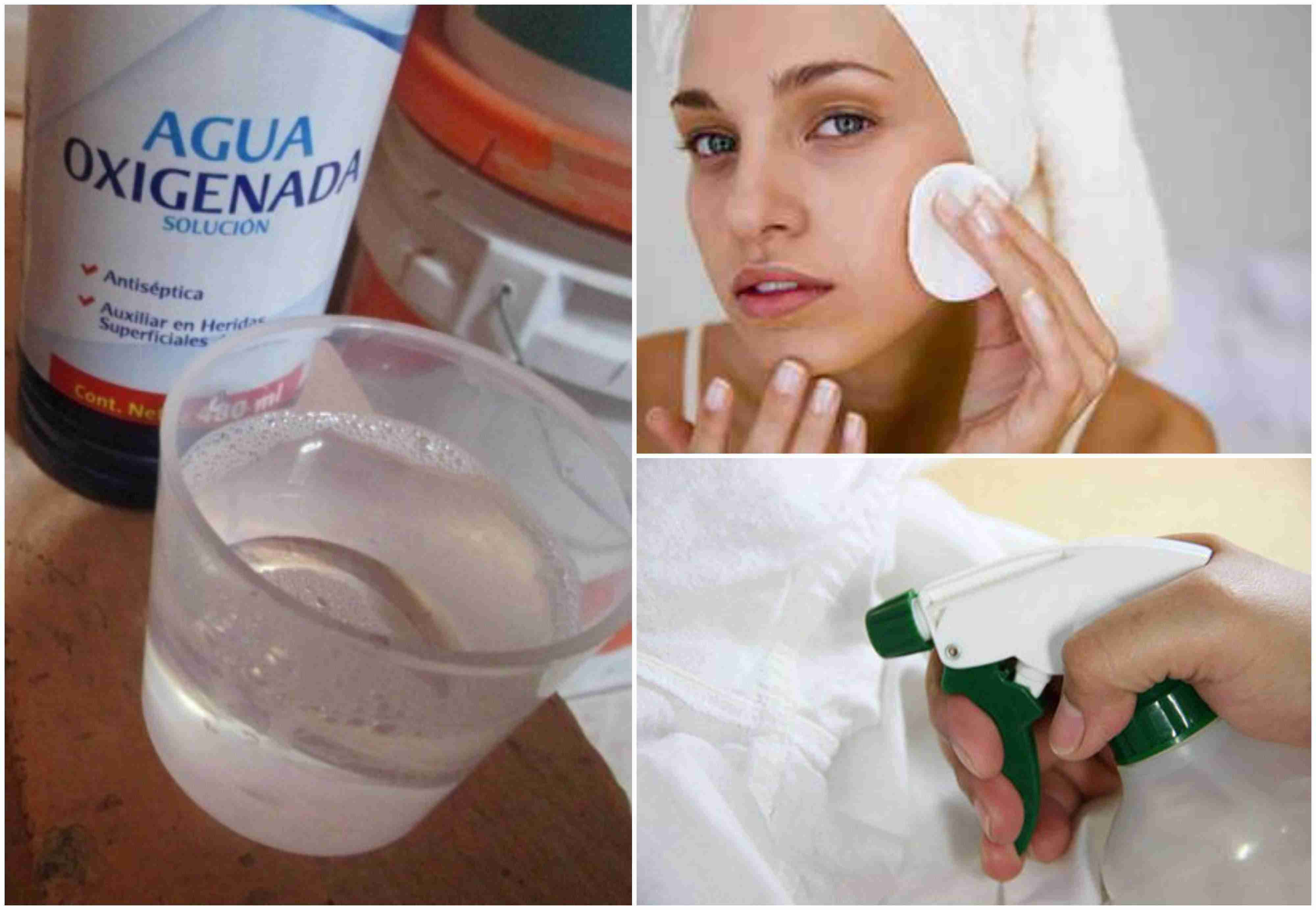 8 USOS DEL AGUA OXIGENADA PARA LA BELLEZA Y LA SALUD —
