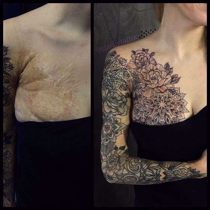 50 Times People Asked To Cover Up Their Scars And Birthmarks, And Tattoo Artists Nailed It