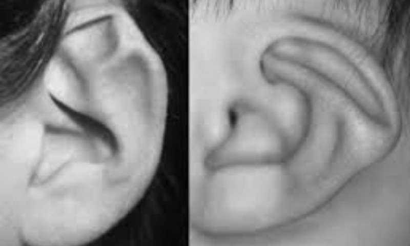Granitos dentro de la oreja