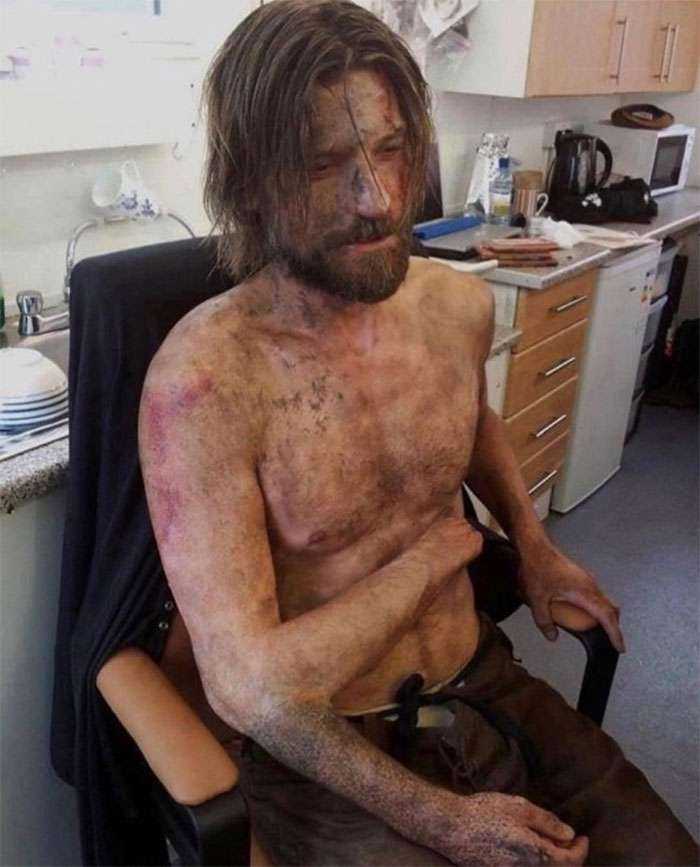 Jamie Lannister y su terrorífico brazo extra