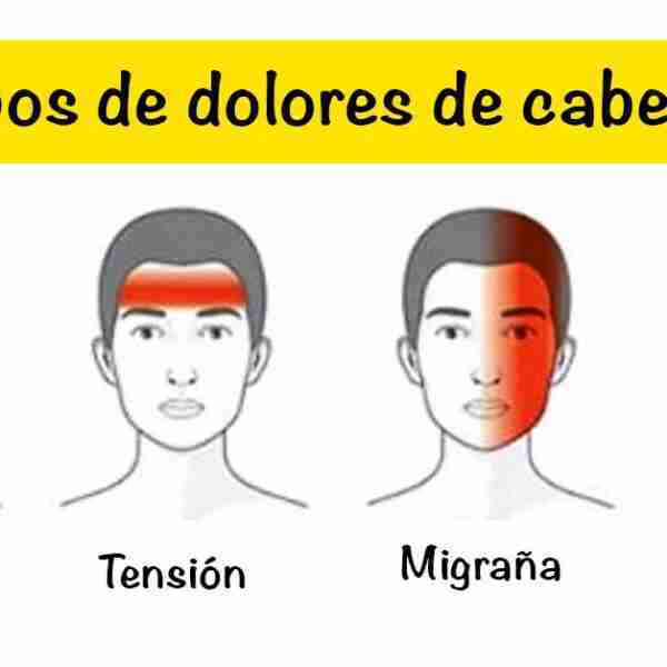 4 Trucos para reconocer los dolores de cabeza más peligrosos rápidamente