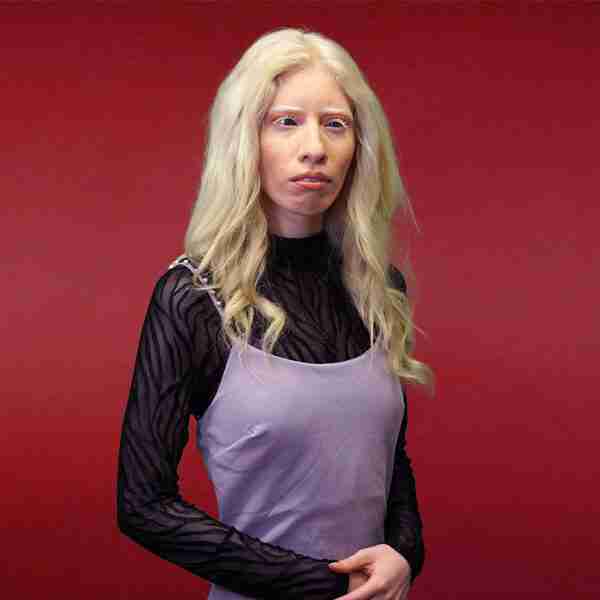 «La gente cree que somos vampiros»: la vida de Ruby Vizcarra, una modelo albina mexicana