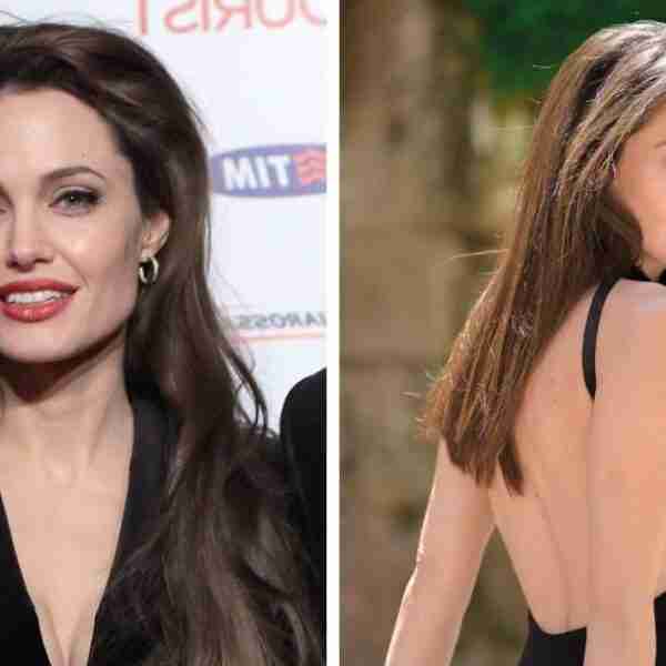 12 personas que se operaron para parecerse a sus ídolos