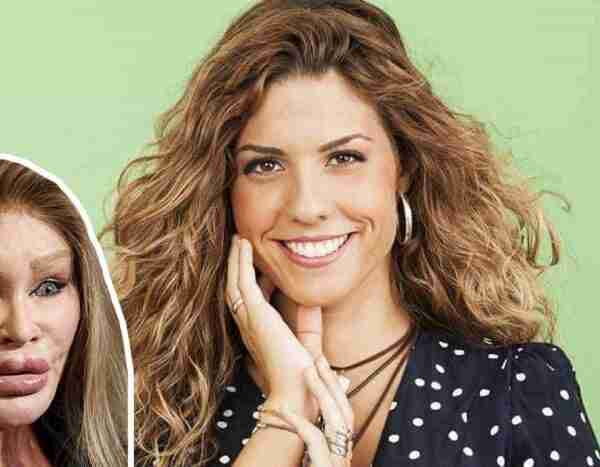 El sorprendente cambio físico de Miriam Rodríguez (‘OT 2017’) tras hacerse varios retoques estéticos