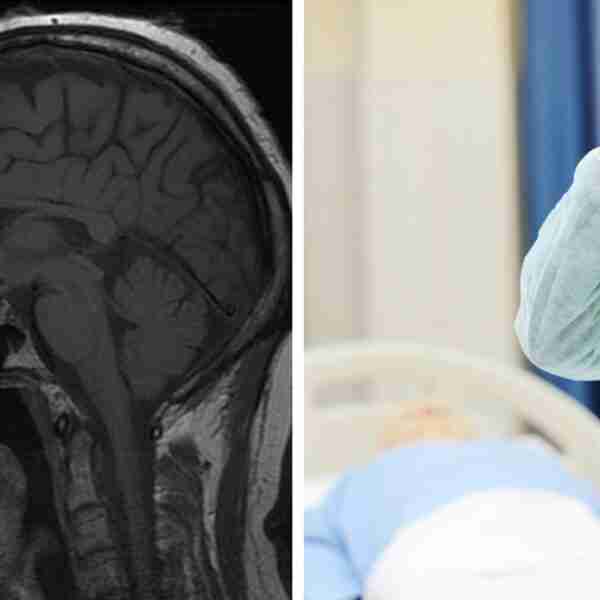 La ciencia descubre dos cosas que ocurren en tu cerebro justo antes de morir