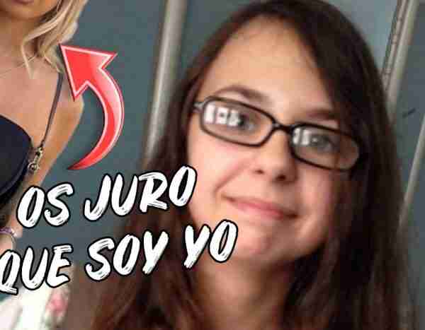 El espectacular cambio físico de una joven tras operarse los pechos y los labios
