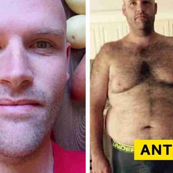 Un hombre muestra su transformación al comer sólo patatas durante 313 días sin parar
