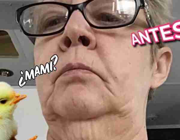 Una mujer impacta a las redes al enseñar su fallido retoque estético: «Parezco un pollo viejo»