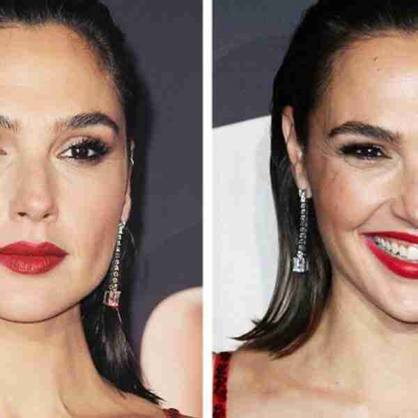 17 fotos comparativas de famosos muestran cuánto cambian sus rostros cuando sonríen