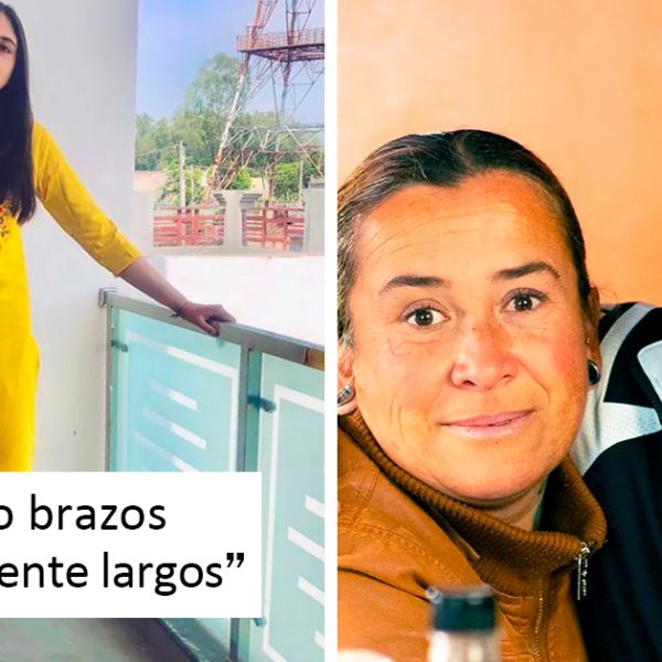 45 Personas únicas mostrando lo impredecible de la genética (nuevas fotos)