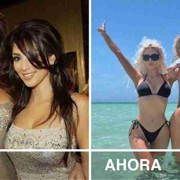 5 pares de hermanas famosas que fueron acusadas de abusar de las cirugías para “verse mejor”