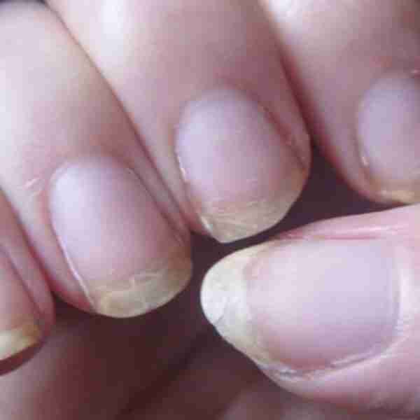 7 Trucos para que no se rompan las uñas y evitar que se caiga el pelo con facilidad