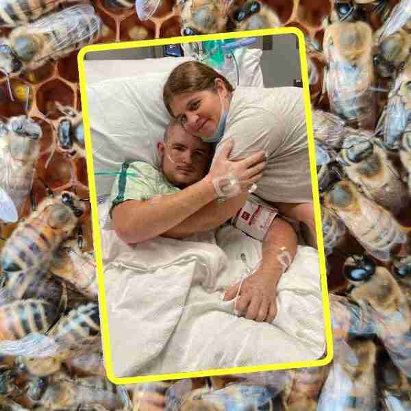 Austin terminó en coma luego de ser picado más de 20 mil veces por abejas africanizadas