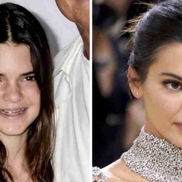 10 famosas que pusieron un pie en Hollywood y cambiaron su apariencia en 180 grados