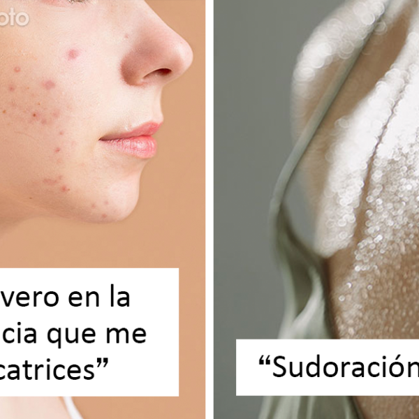 25 Personas que no tuvieron suerte en el reparto de los genes