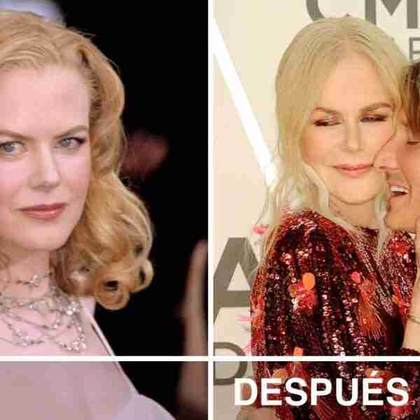 9 fotos comparativas muestran cómo cambiaron los rostros de las celebs después de encontrar el amor