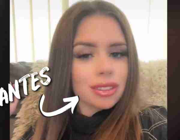 El vídeo viral en el que una joven muestra el desastre dental que le hicieron por 200 euros