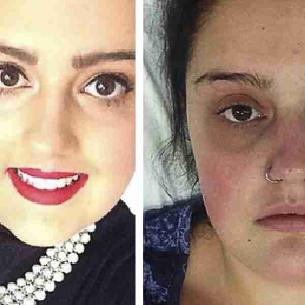 Una chica acaba ingresada en Cuidados Intensivos al descuidarse ‘íntimamente’