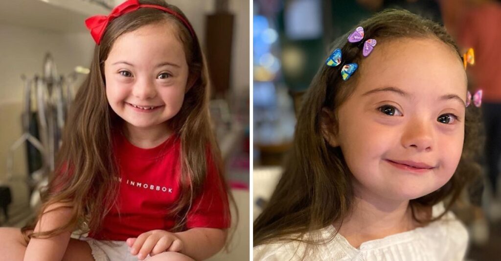 4-year-old girl with Down syndrome shines as she models for Gucci, showcasing her unique beauty