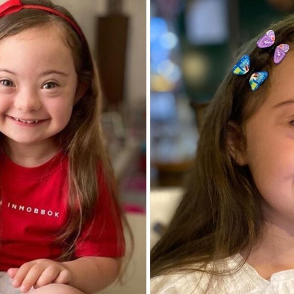 4-year-old girl with Down syndrome shines as she models for Gucci, showcasing her unique beauty