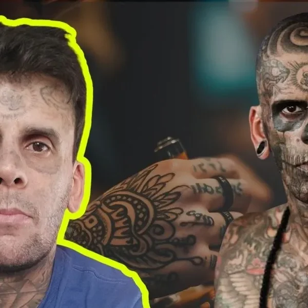 «El dolor es horrible»: Leandro fue el hombre más tatuado de Brasil pero decidió remover todos sus tatuajes